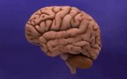 Animation : Rtrcissement d'un cerveau atteint de la maladie dAlzheimer. (Crdit : Institut National du Vieillissement, domaine public, via Wikimedia Commons)